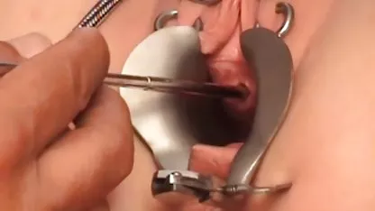 Kecantikan, Hitam indo baru xxx dan putih